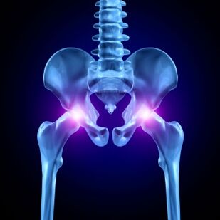 Hip joint pain can be acute, aching, or chronic