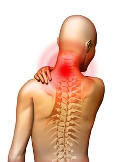 Pain is the main symptom of cervical osteochondrosis