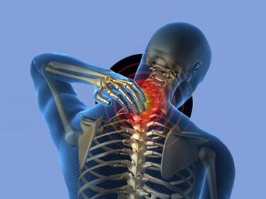 A person with osteochondrosis of the cervical spine is bothered by neck pain